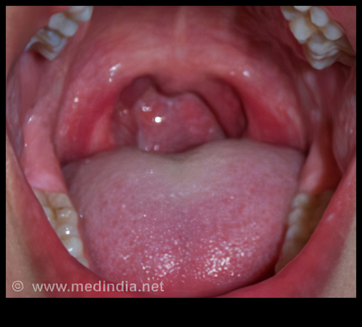 Mazas garšas kārpiņas, liels potenciāls: bērnu uztura meistarība